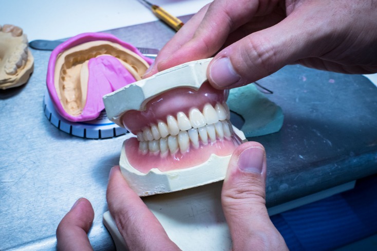 How Dental Implants Protect Oral Health Grandville, MI